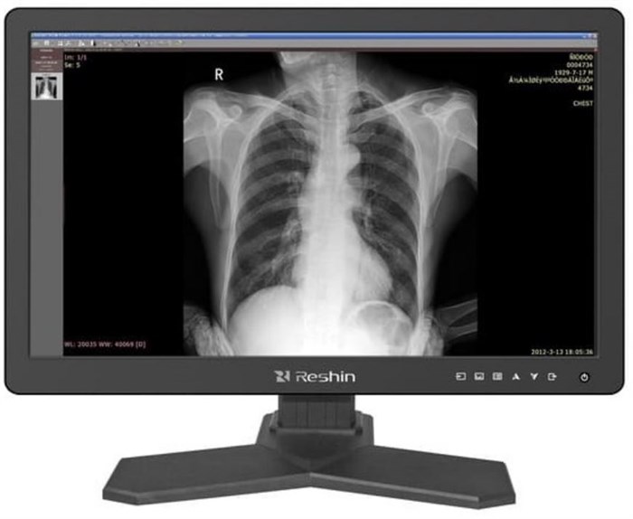 Монитор 24" RESHIN MD26C 126862