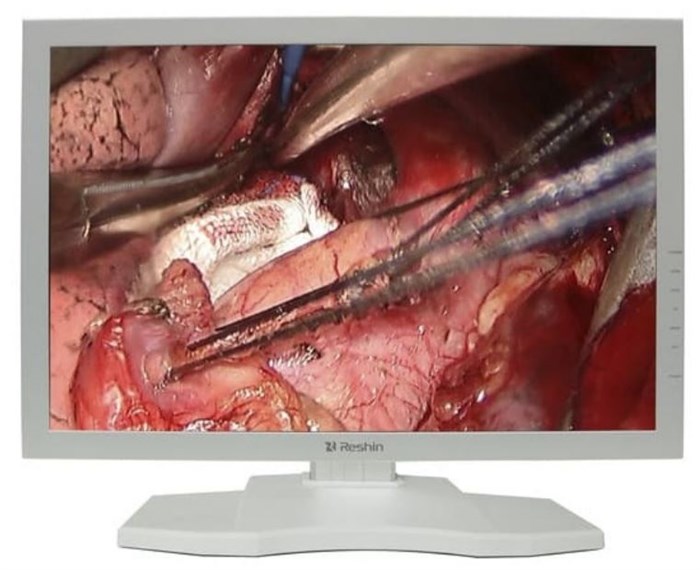 Монитор 24"  MS247SA 126863